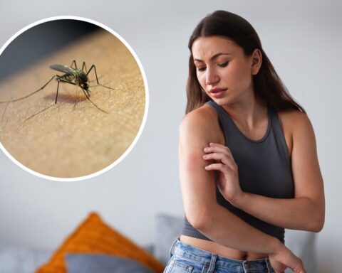 Укусы насекомых летом: как распознать, лечить и когда обращаться к врачу