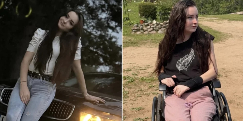 Жизнь 22-летней Дианы изменил травматичный случай: борьба с последствиями аварии