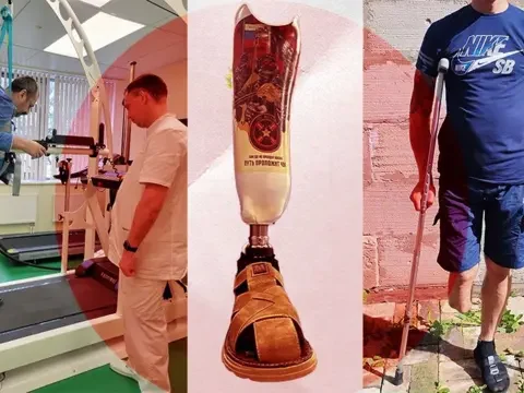 Россия втрое увеличила закупку протезов для инвалидов войны