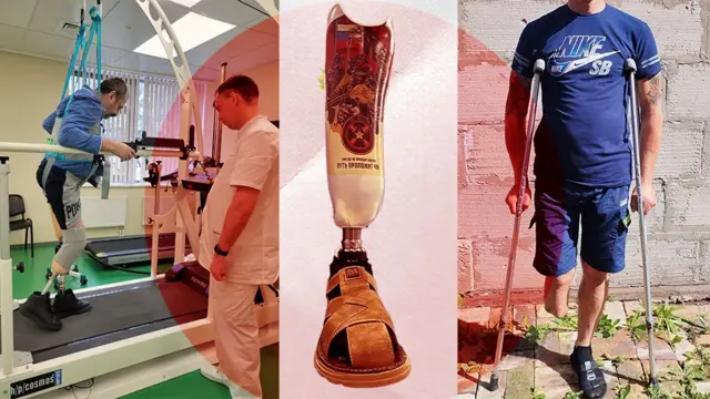 Россия втрое увеличила закупку протезов для инвалидов войны