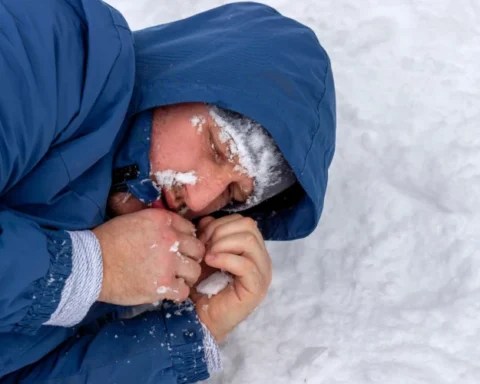 Врачи RAKUS предупреждают о риске ампутации из-за позднего обращения при обморожениях